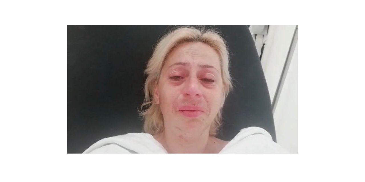 Sokak hayvanlarını beslemek isterken darp edildi