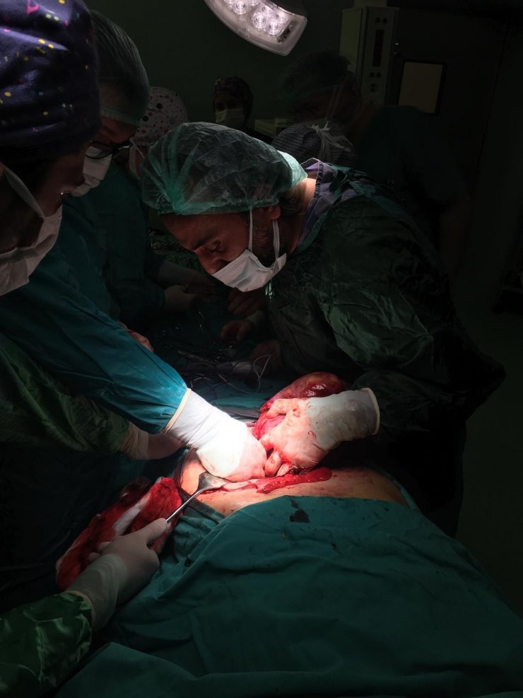 Karnından 6 kiloluk tümör çıkarıldı