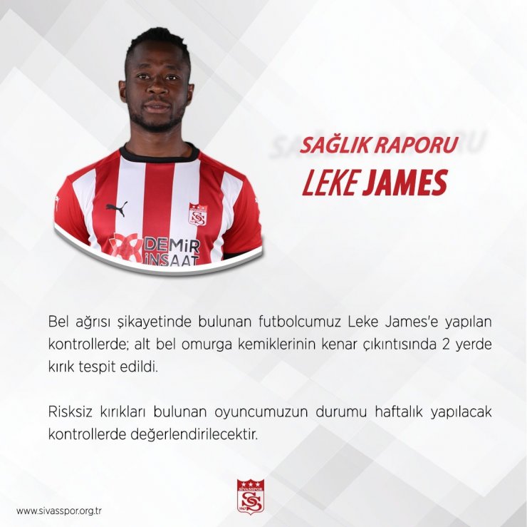 Sivasspor’a Leke James’ten kötü haber!