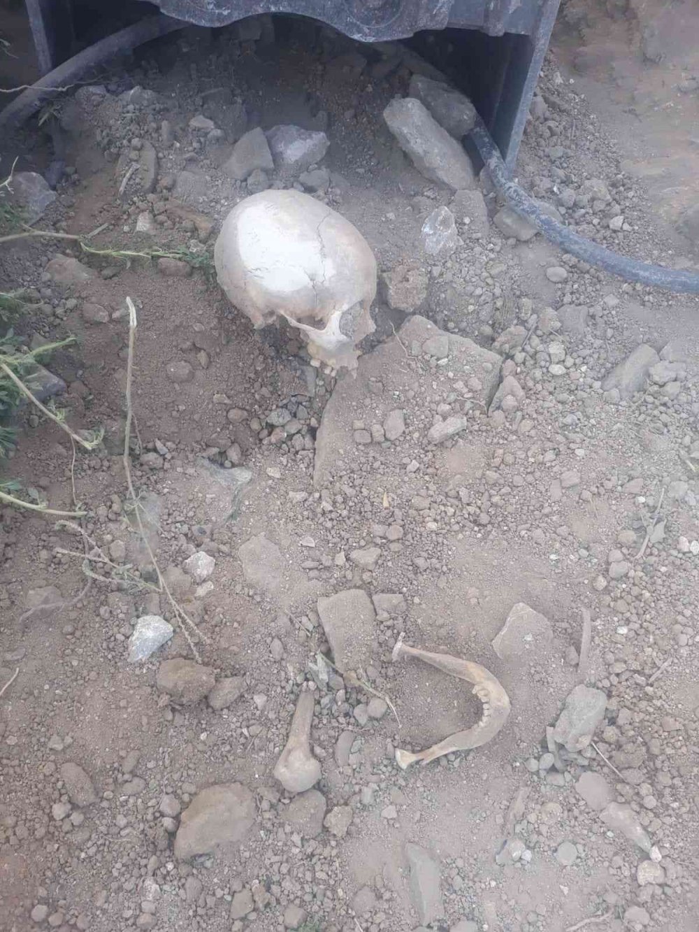 Belediye ekipleri yol çalışması sırasında insan kemikleri bulundu