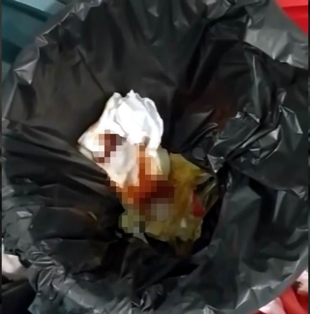 Ameliyat Esnasında Vücudunda Gazlı Bez Unutuldu İddiası