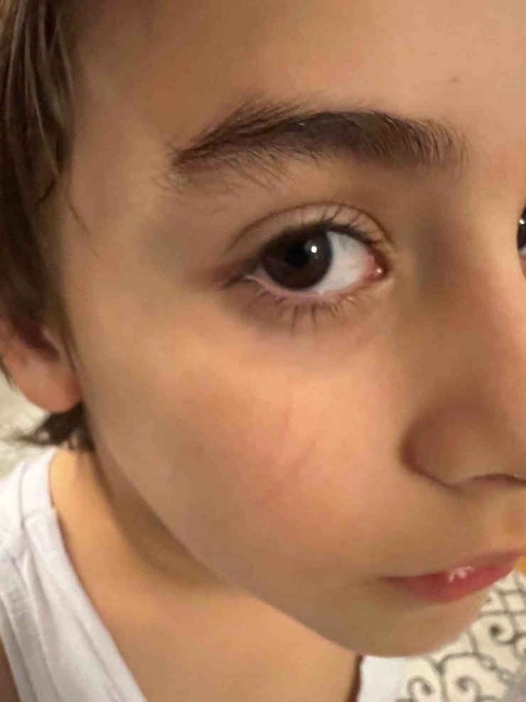 Öğretmenden anaokulu öğrencisine darp iddiası