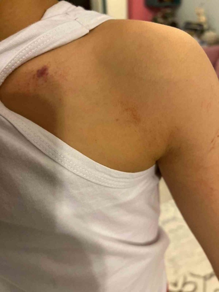 Öğretmenden anaokulu öğrencisine darp iddiası