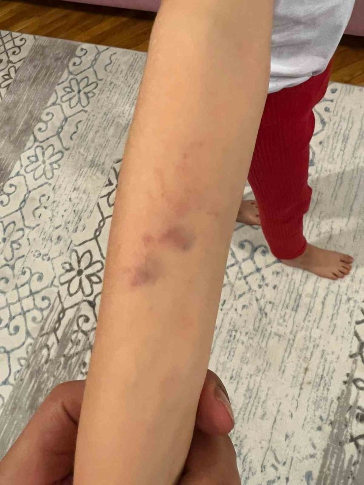 Öğretmenden anaokulu öğrencisine darp iddiası